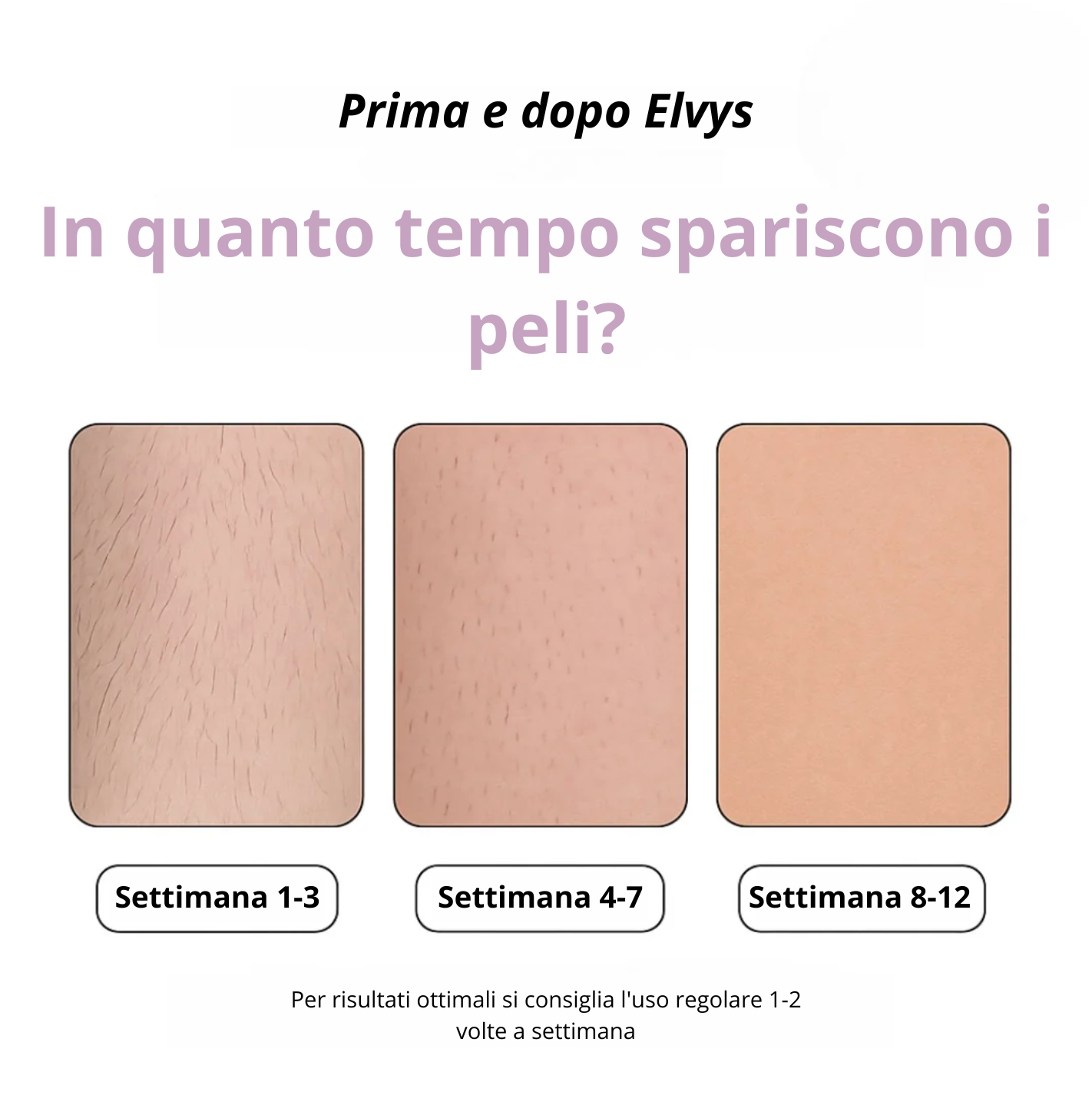 Epilatore IPL Elvys il miglior depilatore laser per uso domestico