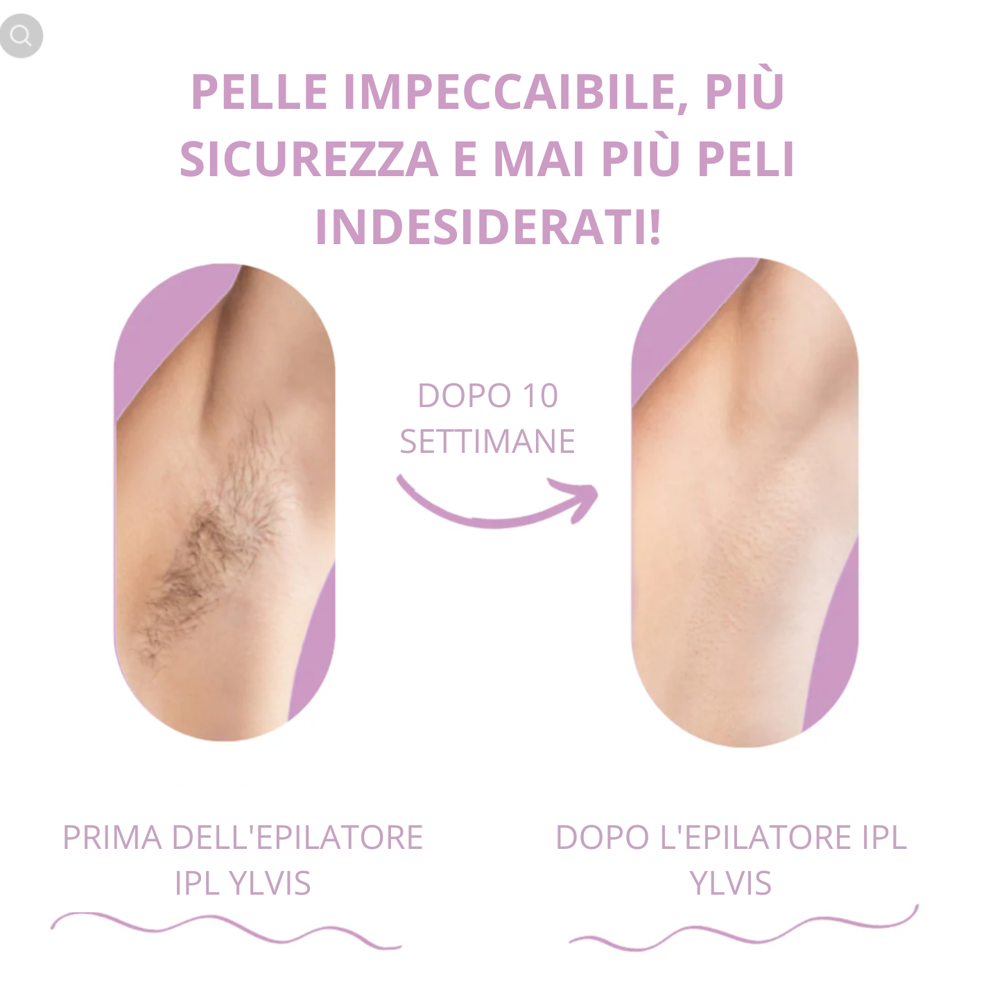 Epilatore IPL Elvys il miglior depilatore laser per uso domestico