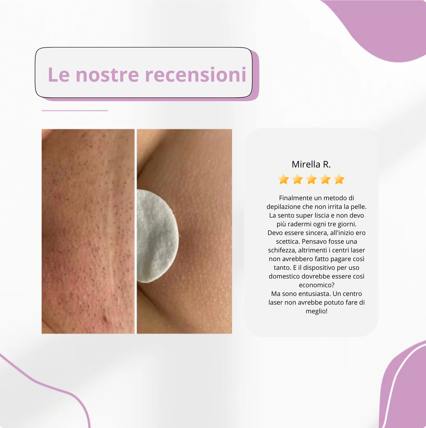 Epilatore IPL Elvys il miglior depilatore laser per uso domestico